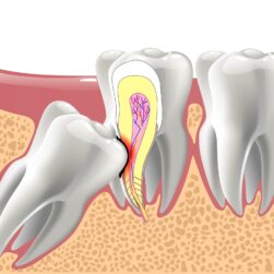 AdobeStock_234710456-scaled