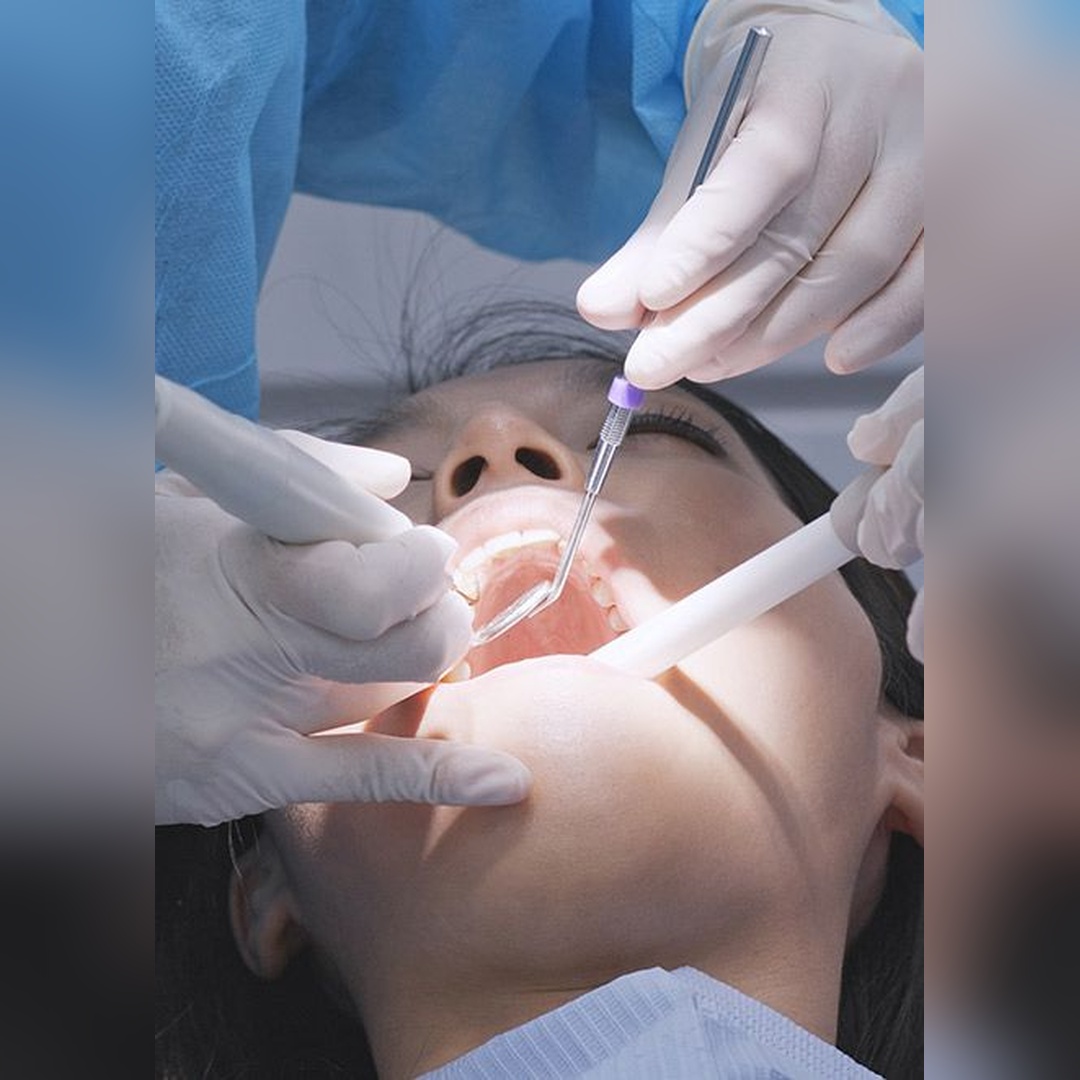 dental scaling 1_square