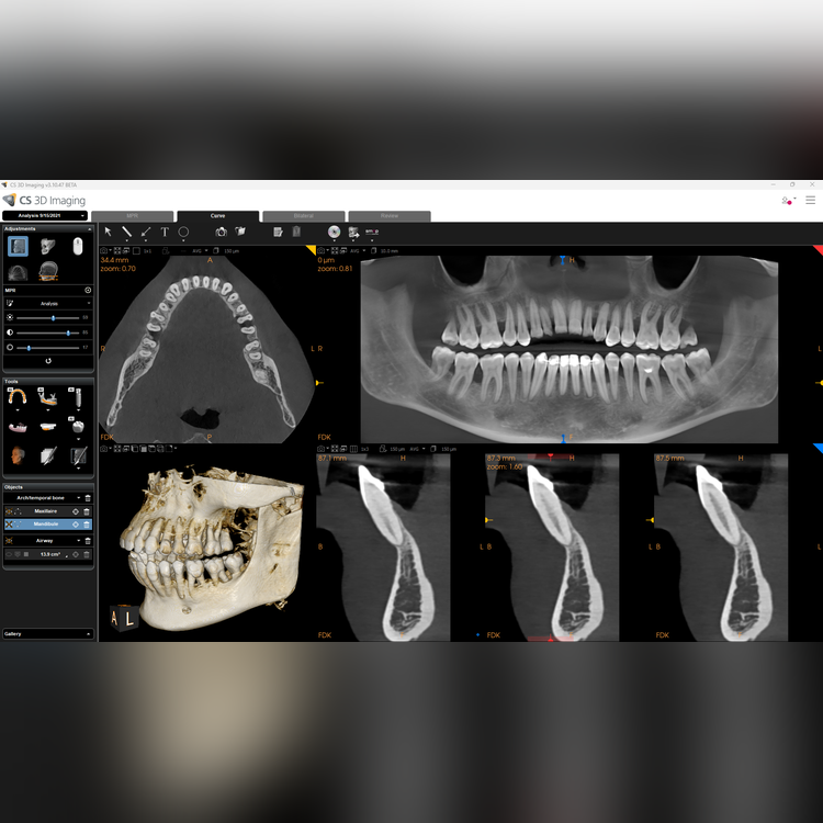 dental_xray_square_3