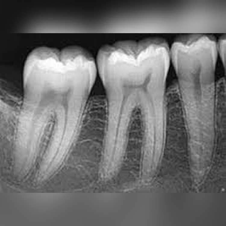 dental_xray_square_4