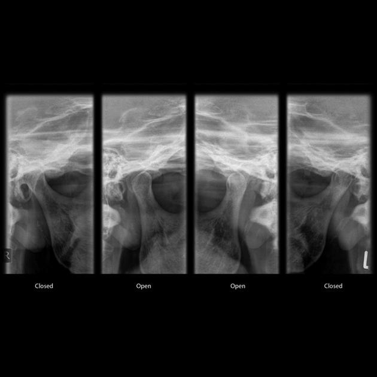 dental_xray_square_5