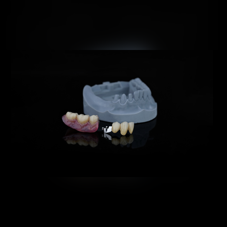 removable_square_1