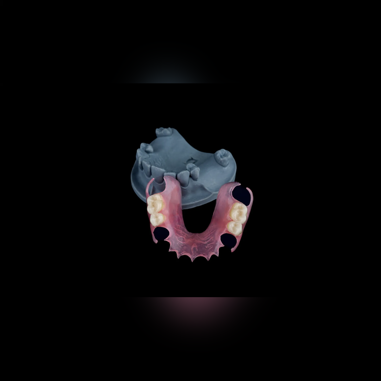removable_square_3