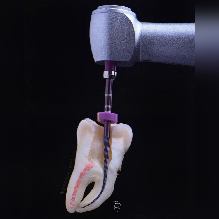 rootcanal_square_2
