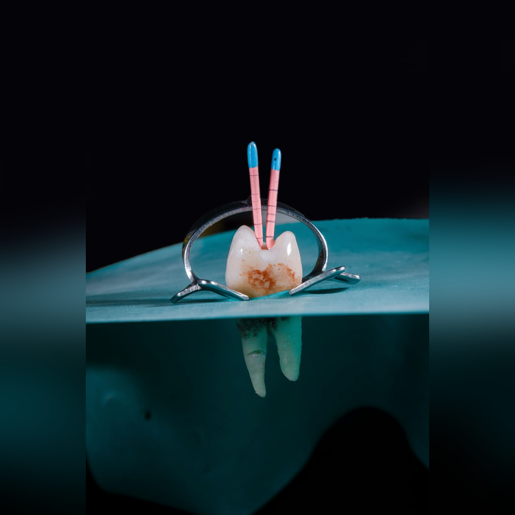 rootcanal_square_3